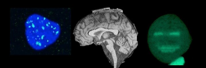 Sherif El-Khamisy banner