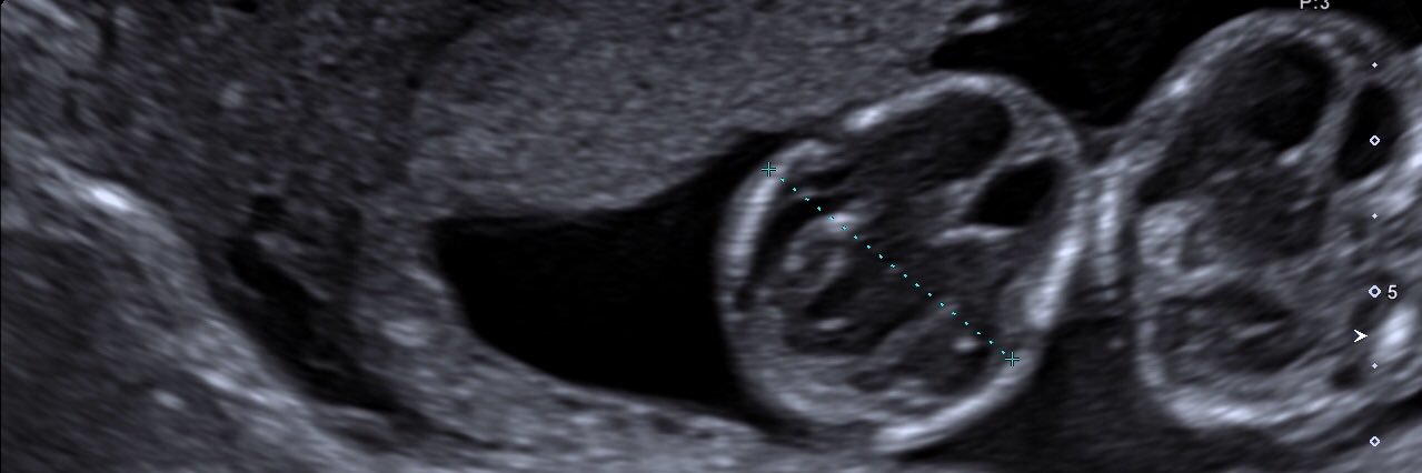 Simone Chaudhary banner