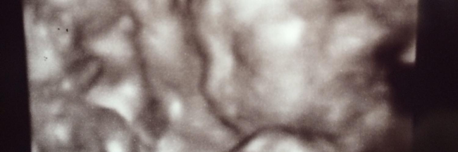 2mietwitt's profile banner image
