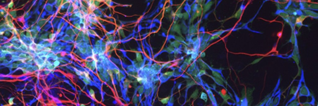VIB-KU Leuven Center for Brain & Disease Research's banner