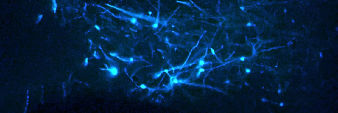 BRAIN at AU banner