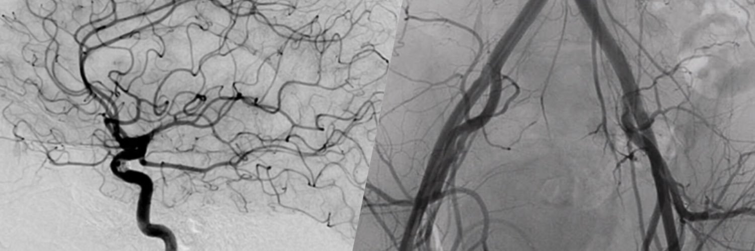 Abdullah Abohimed banner