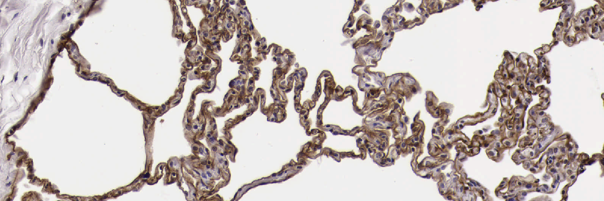 Lungbio's profile banner image