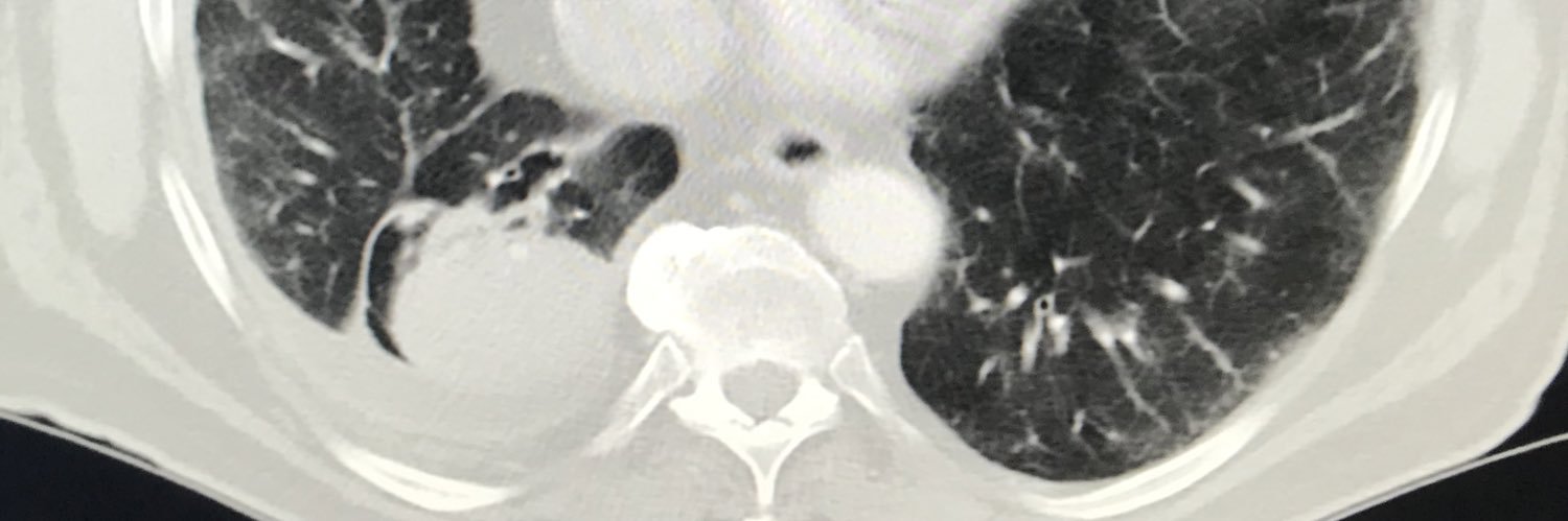 RKlingsberg's profile banner image