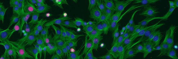 hofearnhead1 Profile Banner