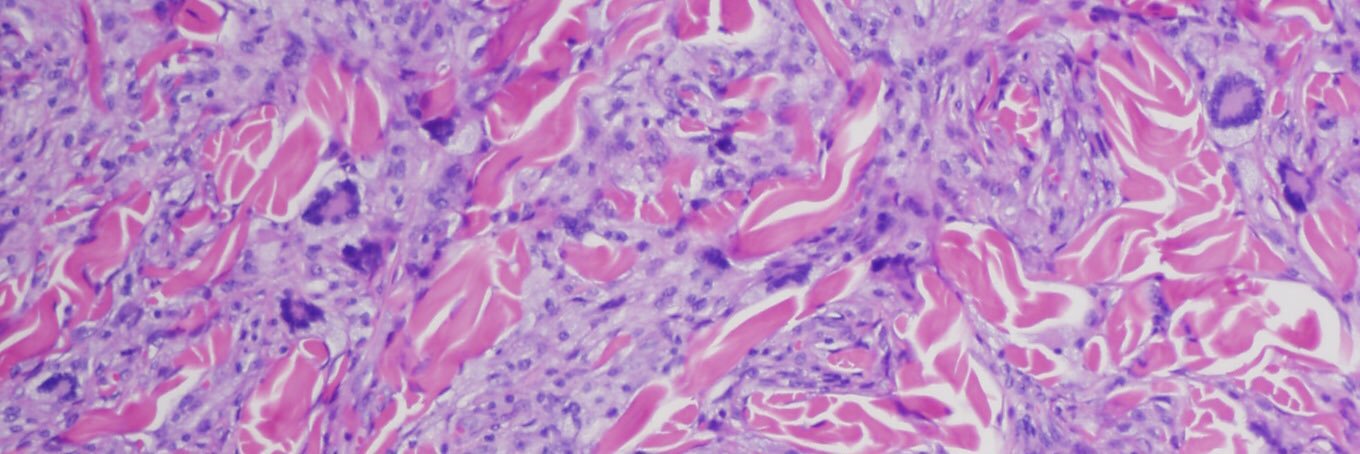 Megan Ketcham banner