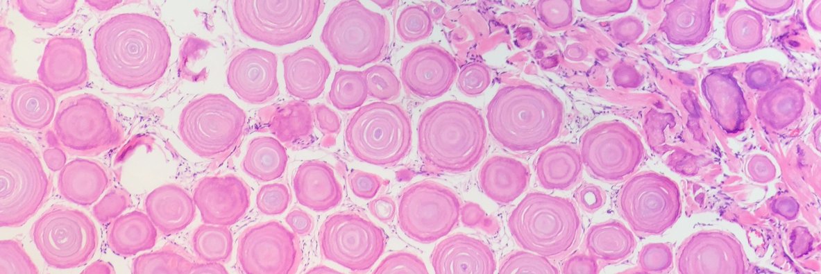 Jason Scapa, MD, FCAP banner