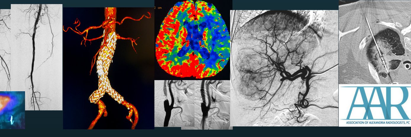 Alexandria CVIR banner