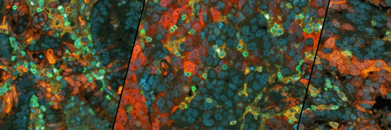 Anand D Jeyasekharan banner