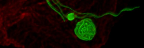 ImmunoFever Profile Banner
