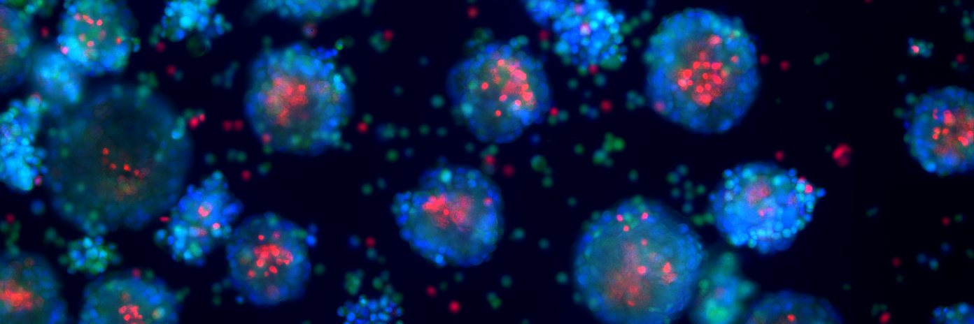 Fabrice Gielen banner