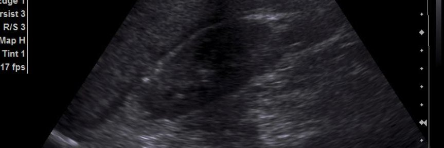 PoCUS FOAMed banner