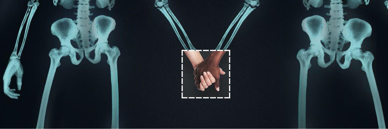 ADL San Francisco banner