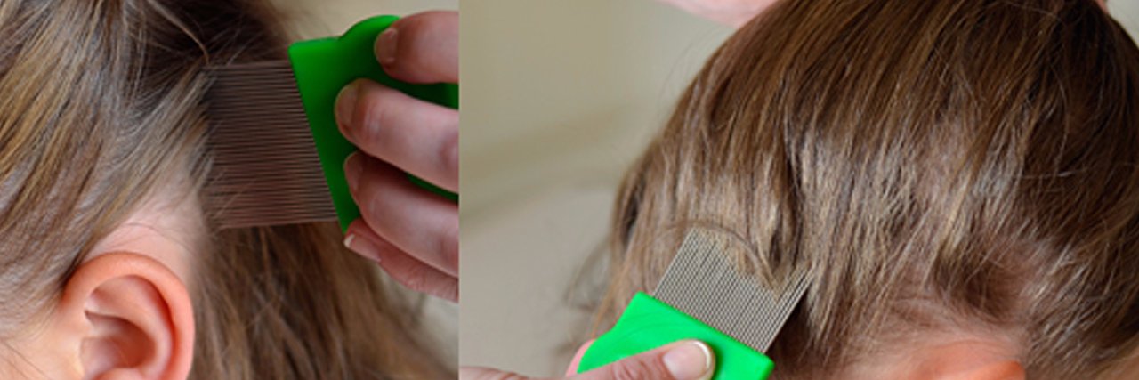 Magic Anti Lice Comb banner