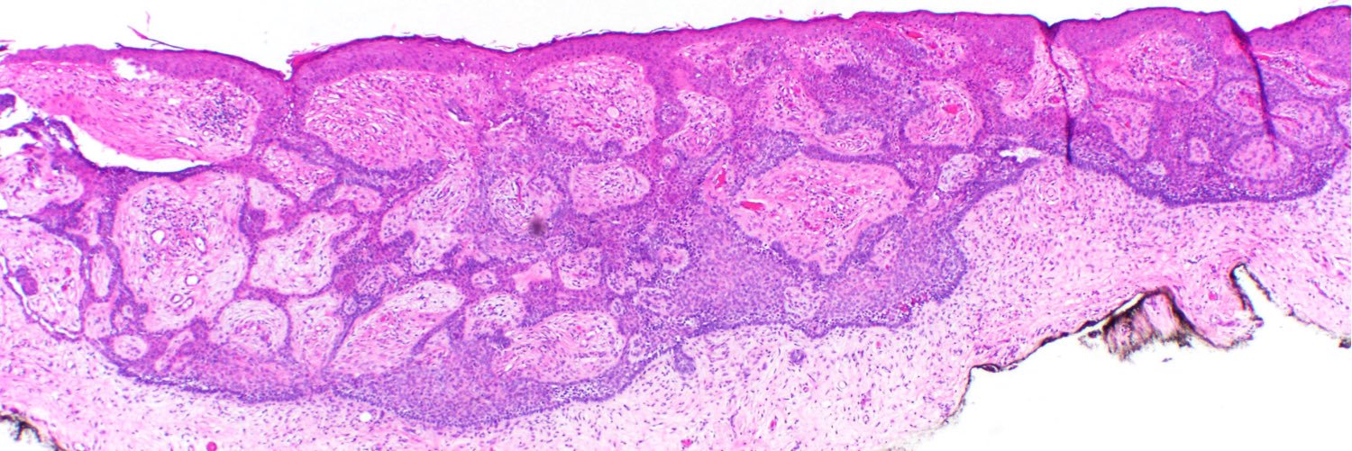 Int Soc Dermpath banner