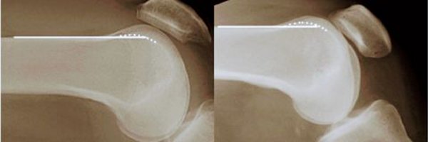 TheKneeJournal Profile Banner