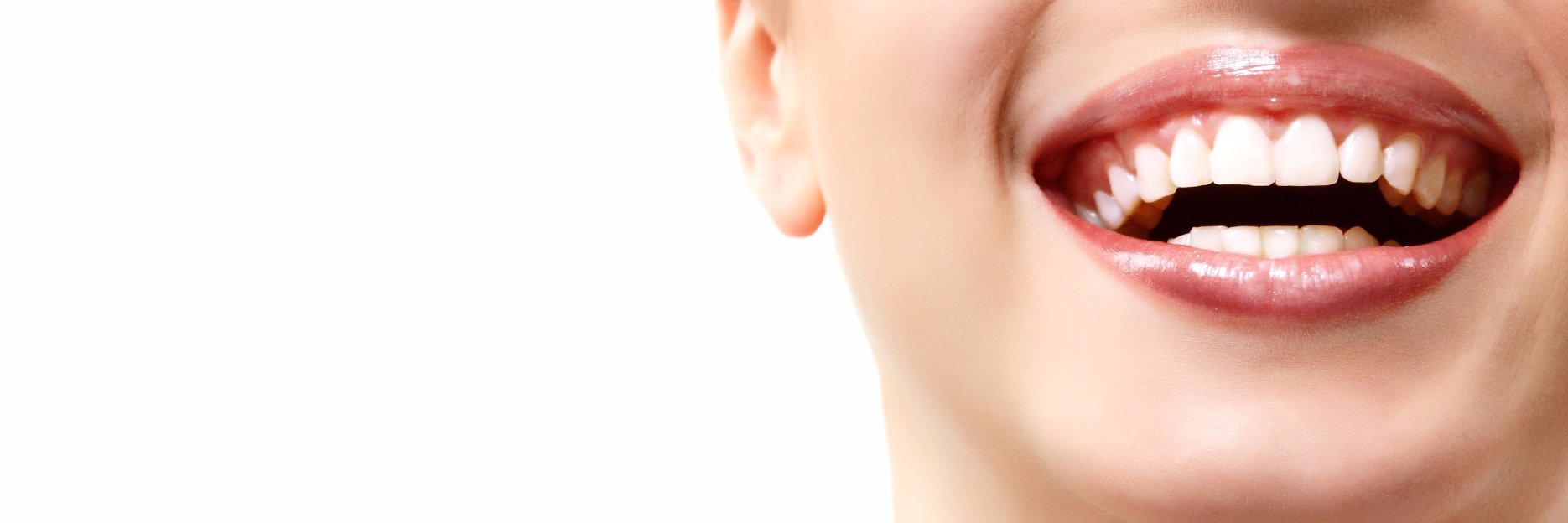 White Smiles banner