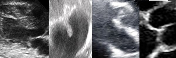 mghedus Profile Banner