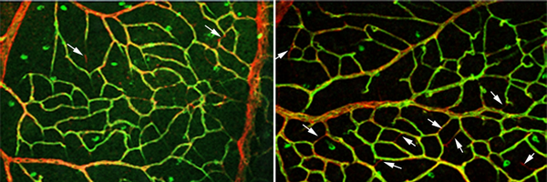 sf_angiogenese Profile Banner