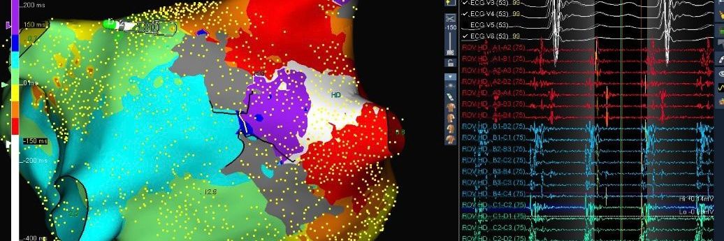 Dinesh Seenivasalu banner