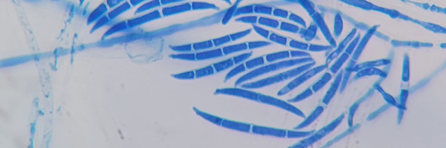 Claudette Dewing banner