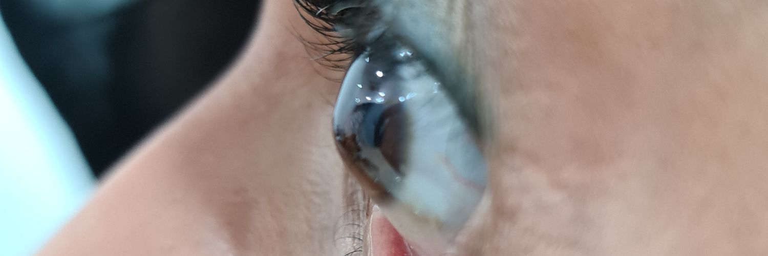 scleralcontacts's profile banner image