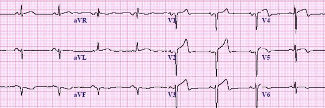 Professor Finesser banner