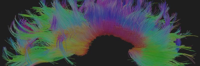 Harrison Canning banner