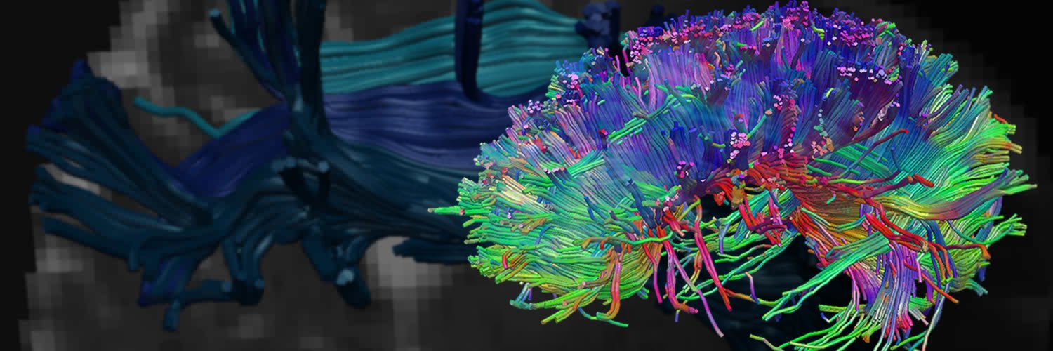 The Centre for Human Brain Health banner