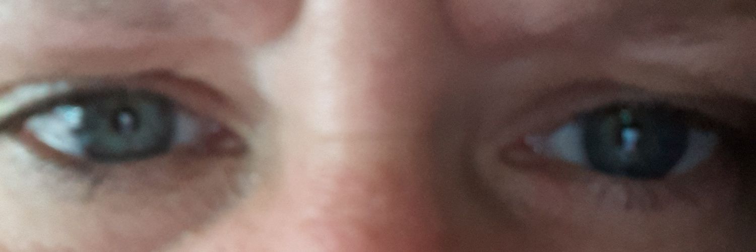 KJsEyebrowBlindness banner