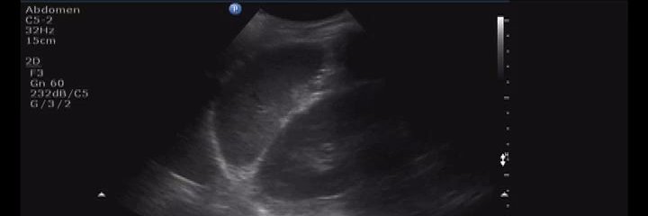 BMCUltrasound banner