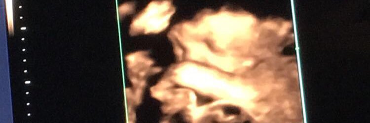 Awesomest_chik's profile banner image