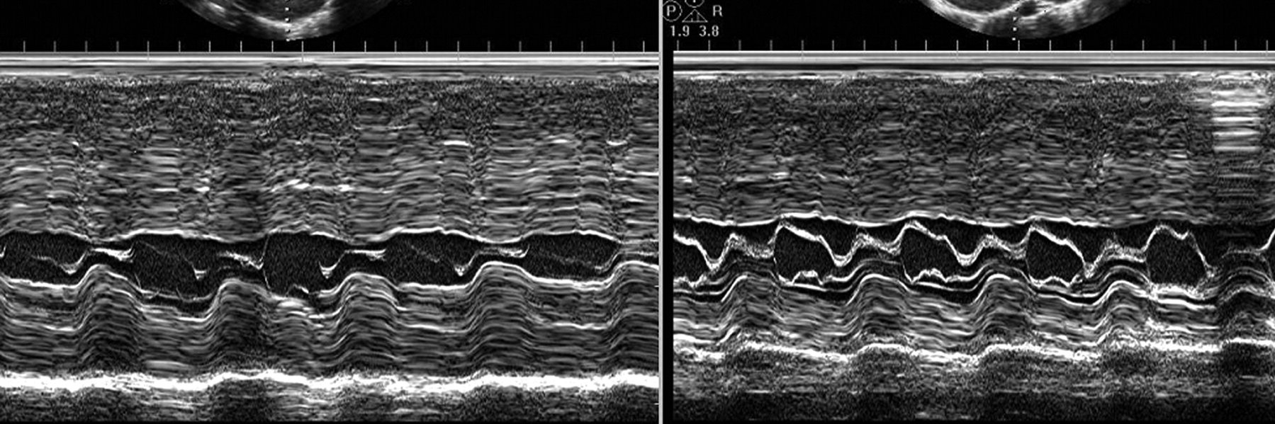Echocardiography banner