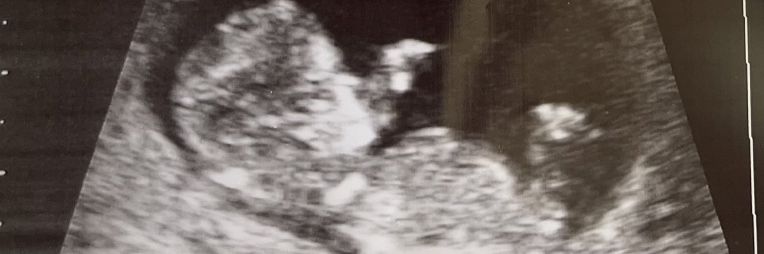 Jer2raw's profile banner image