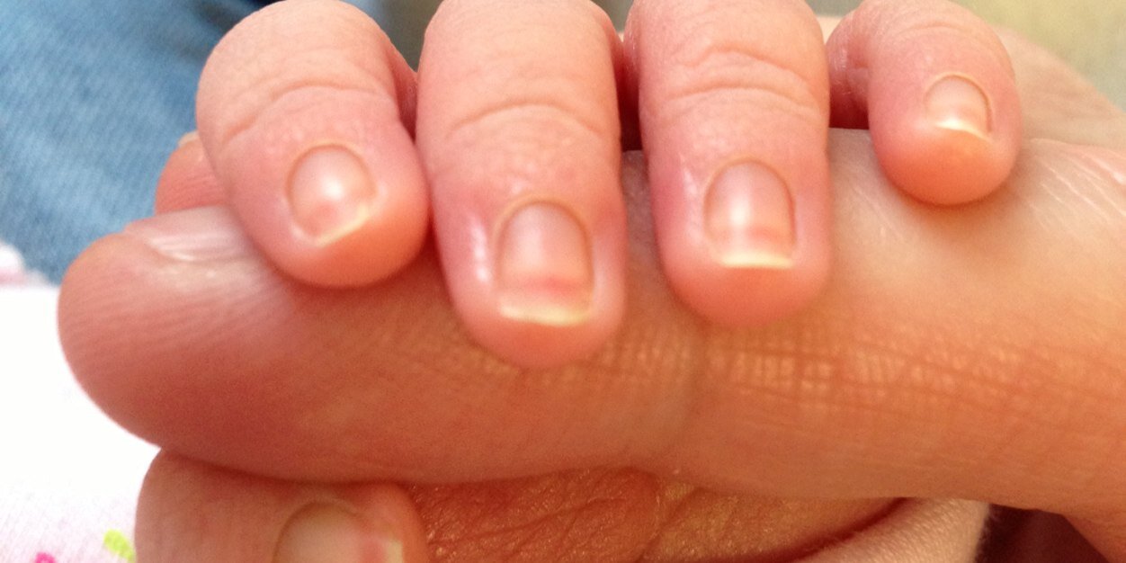 Diarmuid Beegan banner