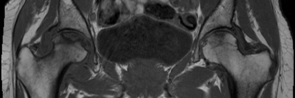 Klonmich Profile Banner