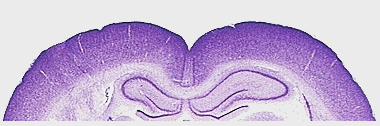 Claudia Cecchetto banner