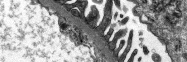 BetterKidneys Profile Banner
