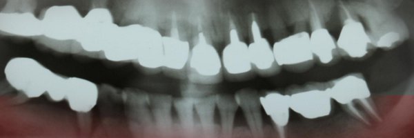 PI_Advisory Profile Banner