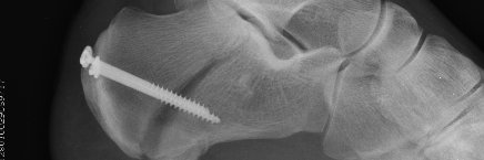 李家のキムチ banner