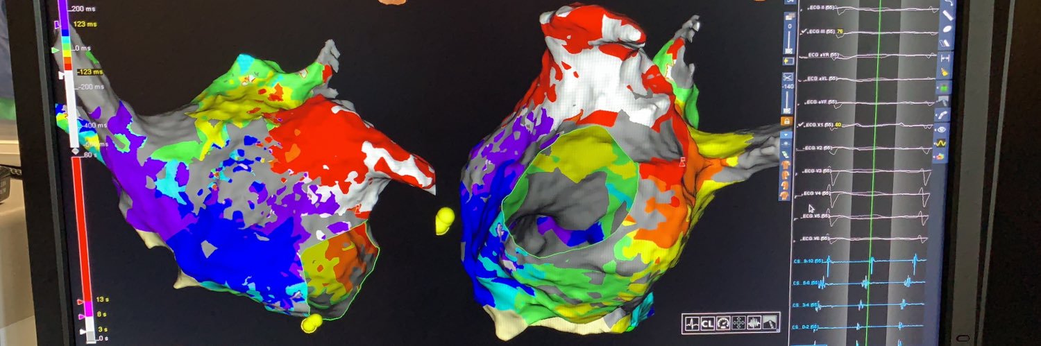 Preston Segars banner