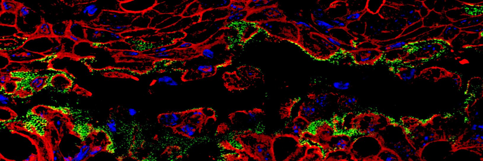 Theresa Alenghat banner