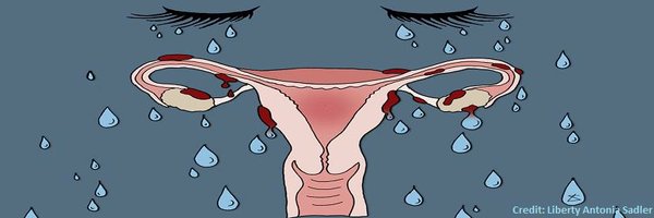 EndoSurvivors Profile Banner