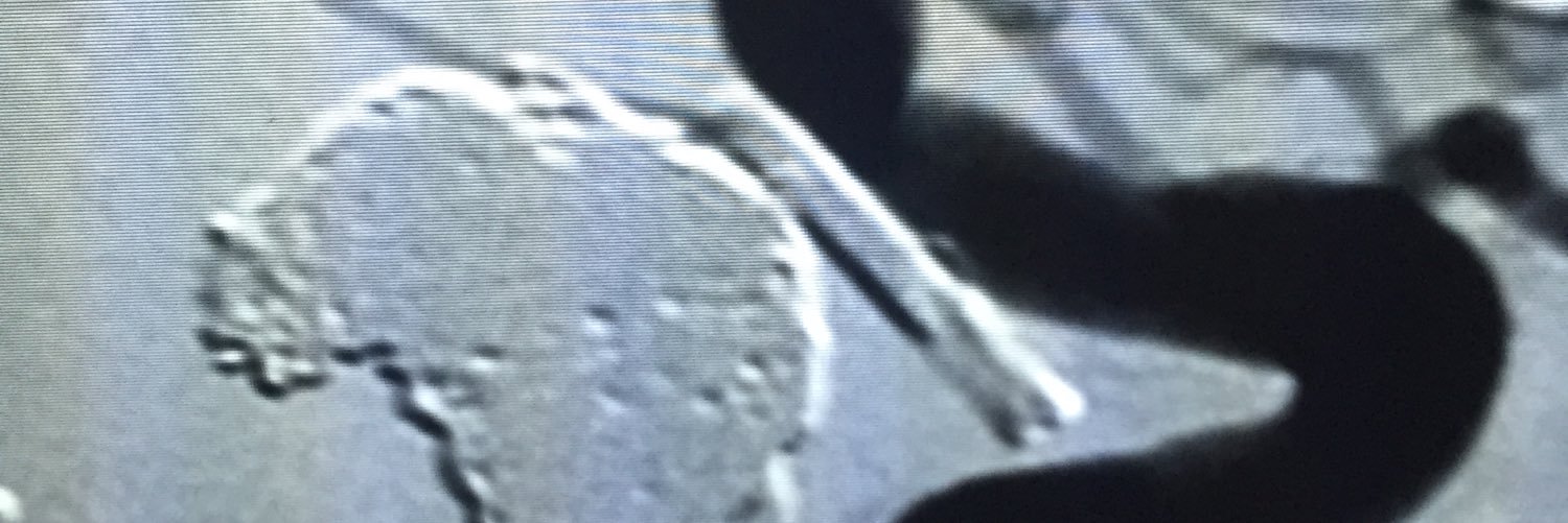 Mark Bain, MD, MS banner