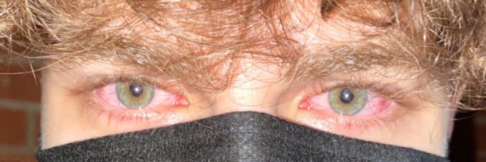 lilypadsvn7 banner