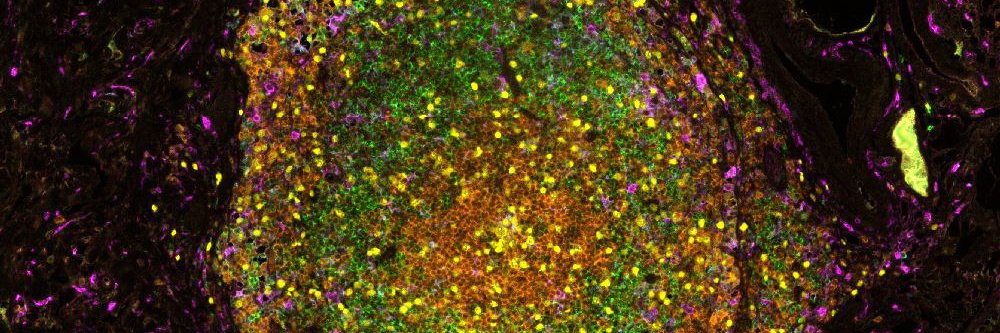 Eóin McNamee banner