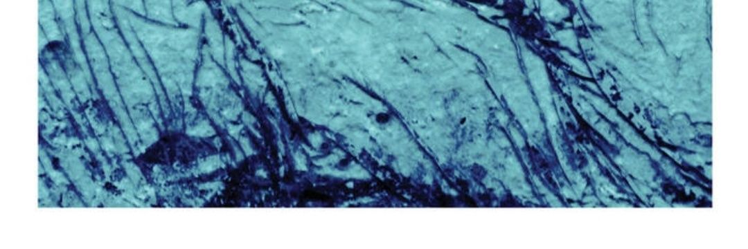 Whettman Chelmets banner