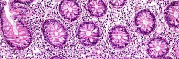 AusGIPath Profile Banner