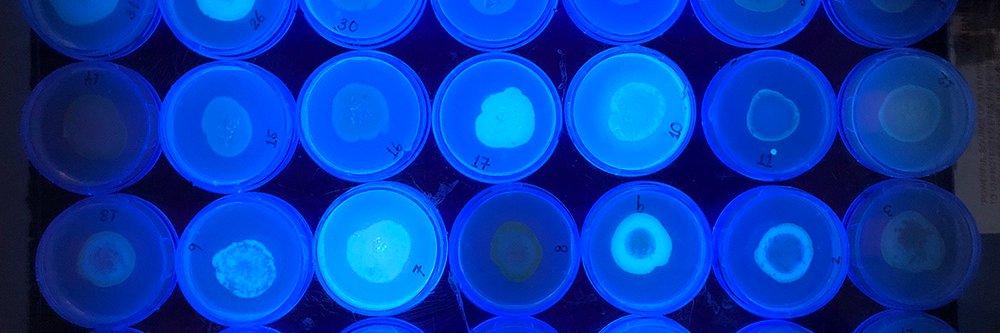 Pukkila-Worley Lab is also @rpwlab.bsky.social banner