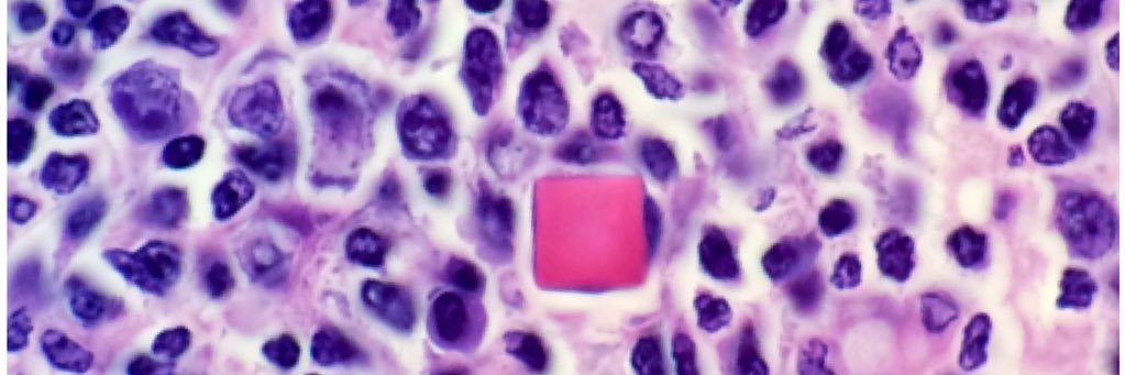 Forest Huls, MD banner